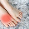 長引く足の甲の痛みは疲労骨折かも？症状と原因・予防